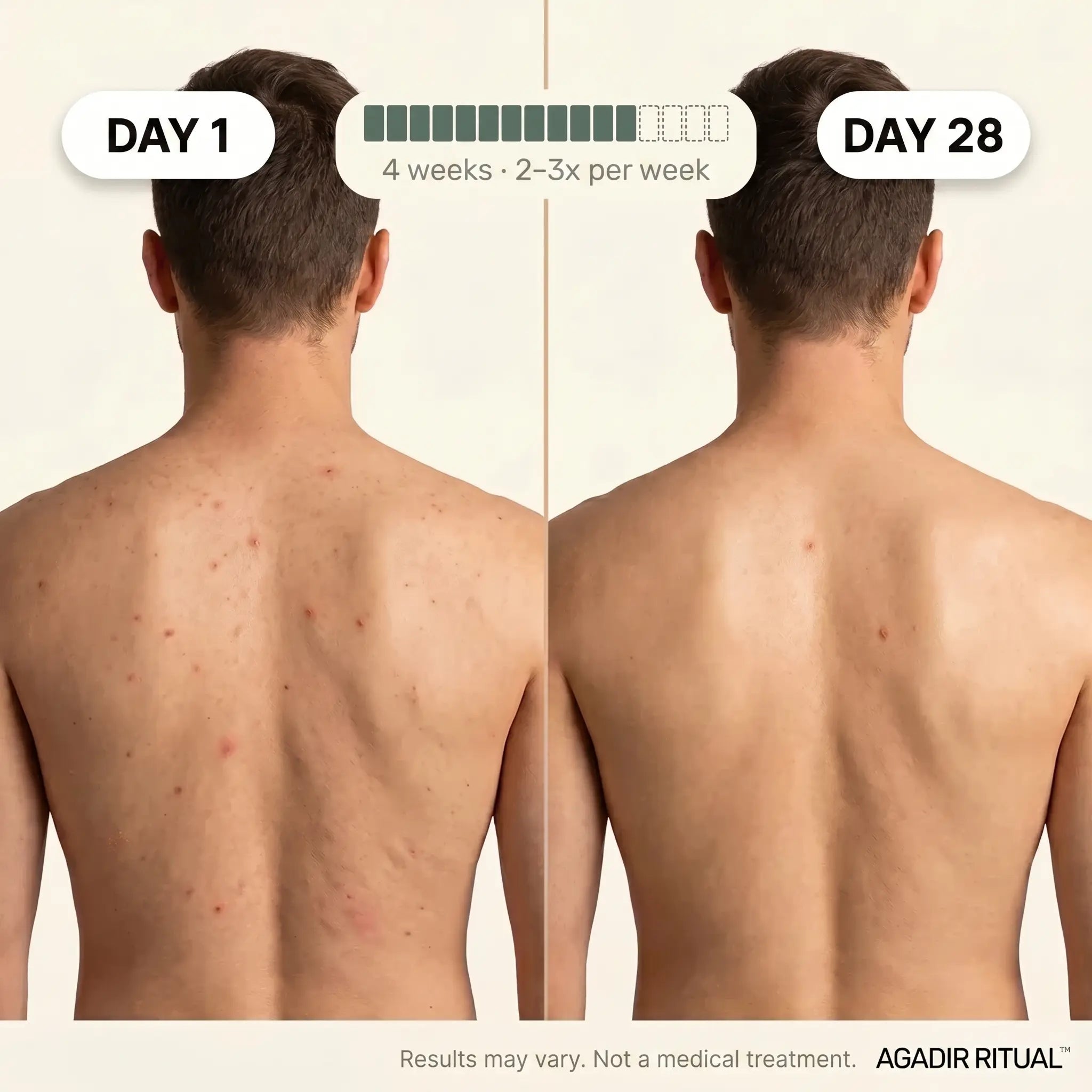 Hammam Exfoliating Shower Towel™